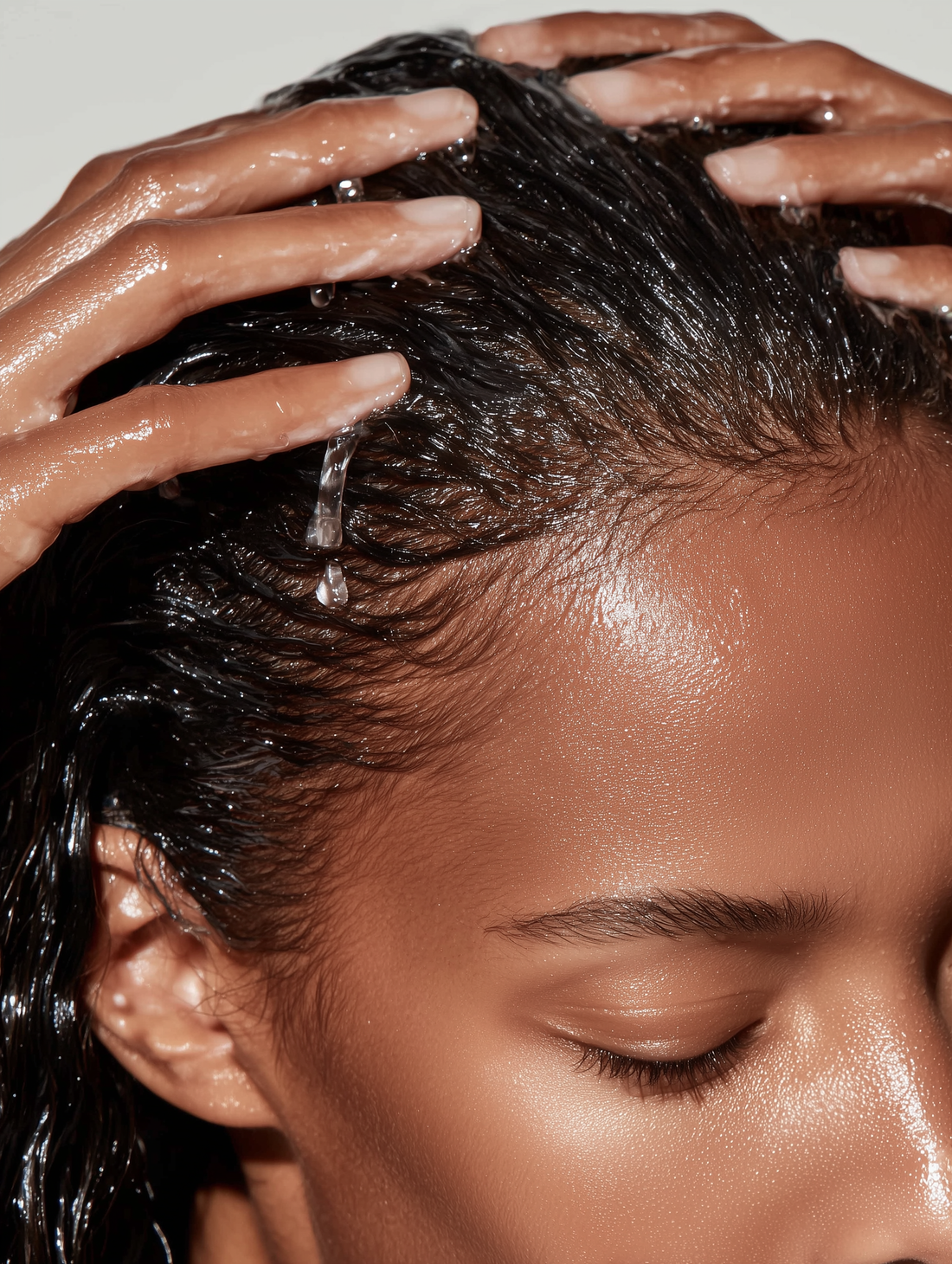 Is This Dandruff on My Scalp?